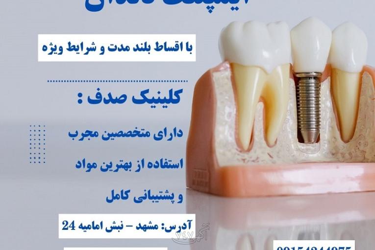 کاشت ایمپلنت بدون فشار مالی با اقساط بلند مدت