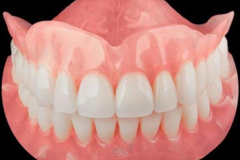 دندانسازی محلات 