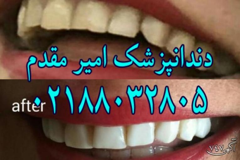 دندانپزشک ملاصدرا دکتر امیر مقدم  لامینیت،ایمپلنت،اصلاح طرح دندان